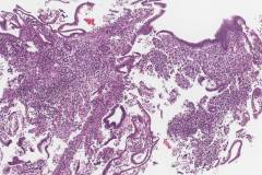 Inactive endometrium