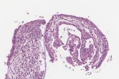 Inactive endometrium