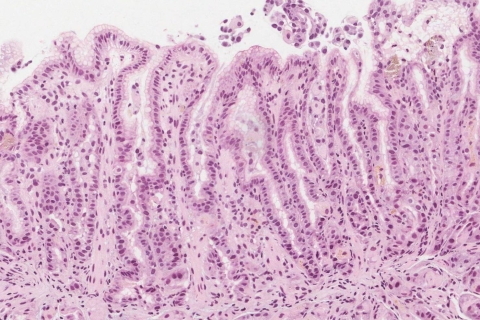 Stomach | Ottawa Atlas of Pathology