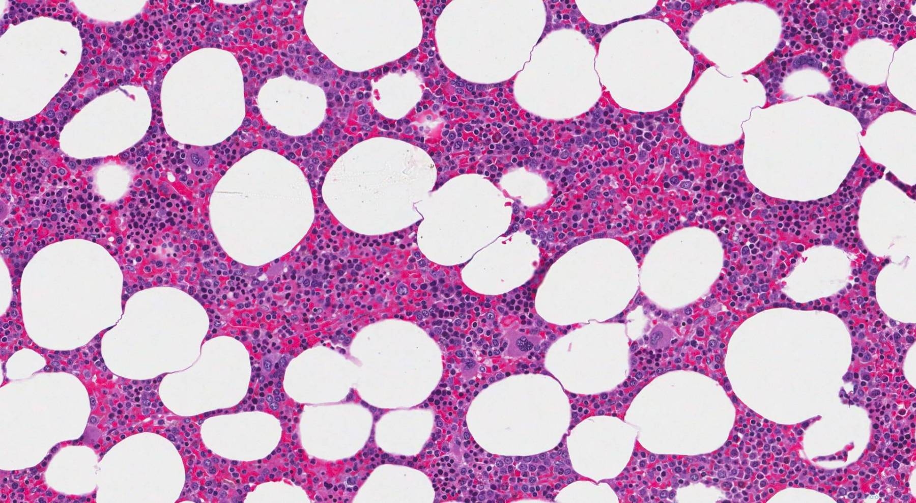 myelolipoma-atlas-of-pathology