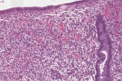 Proliferative phase endometrium