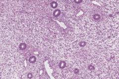 Proliferative phase endometrium