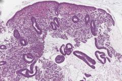 Proliferative phase endometrium