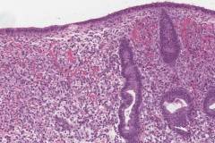 Proliferative phase endometrium