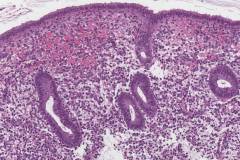 Proliferative phase endometrium