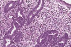 Proliferative phase endometrium