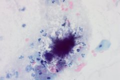 Actinomyces