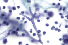 Aspergillus