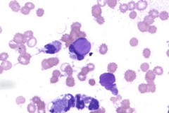 Lupus erythematosus cell