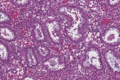 Late secretory endometrium