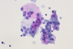 Trichomonas